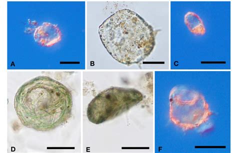  Hartmannella! Une Amoebozoaire Inconnue aux Facettes Fascinantes