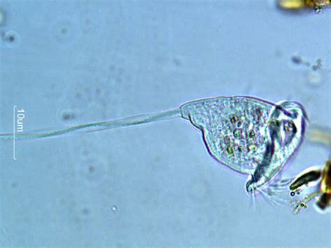  Vorticella! Découvrez ce Prédateur Aquatique à la Couronne Tournoyante